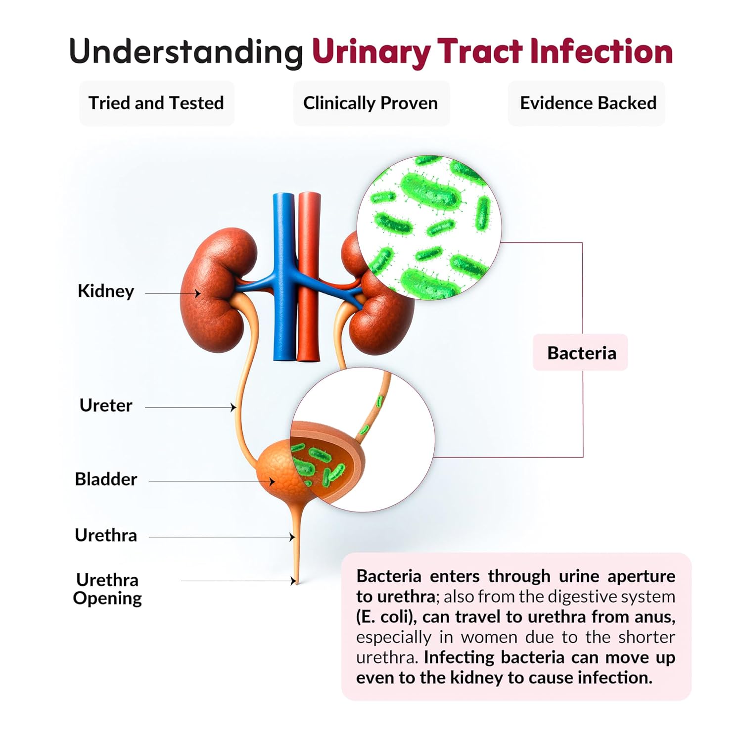 UT Health | UTI Prevention & Urinary Tract Support | With Cranberry Extract, D-Mannose, Hibiscus & 2 Probiotics | Helps Reduce Burning & Pain | Cranberry Flavour, 30 x 2g Powder Sachets - Image 4