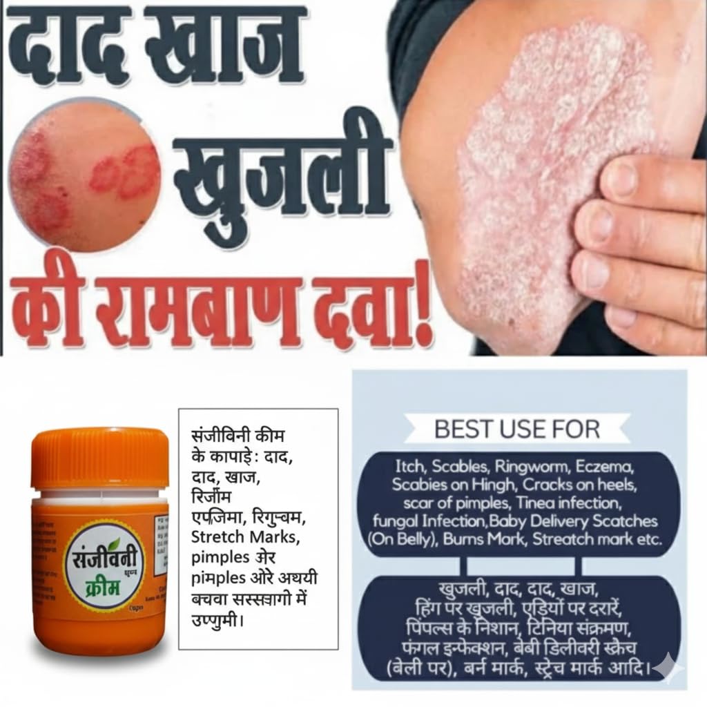 Super Eczema Fungal Cream For Men & Women Ayurvedic ItchCoat Anti Fungal Malam For Ringworm itching Eczema (Sanjivanii Fungal Cream, 15gm pack of 2) - Image 3