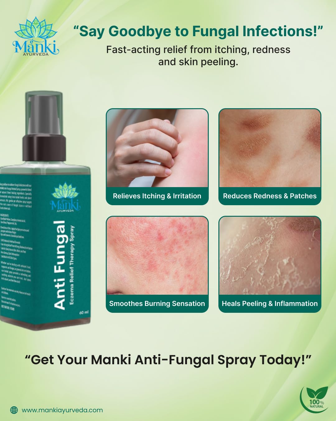 Herbal Anti Fungal Spray | Skin Care Spray for Itching, Odour & Irritation | Natural Ingredients | Suitable for Feet, Underarms & Body | 60ml - Image 3
