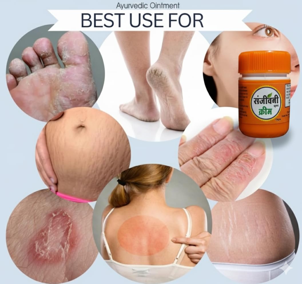 Super Eczema Fungal Cream For Men & Women Ayurvedic ItchCoat Anti Fungal Malam For Ringworm itching Eczema (Sanjivanii Fungal Cream, 15gm pack of 2) - Image 2