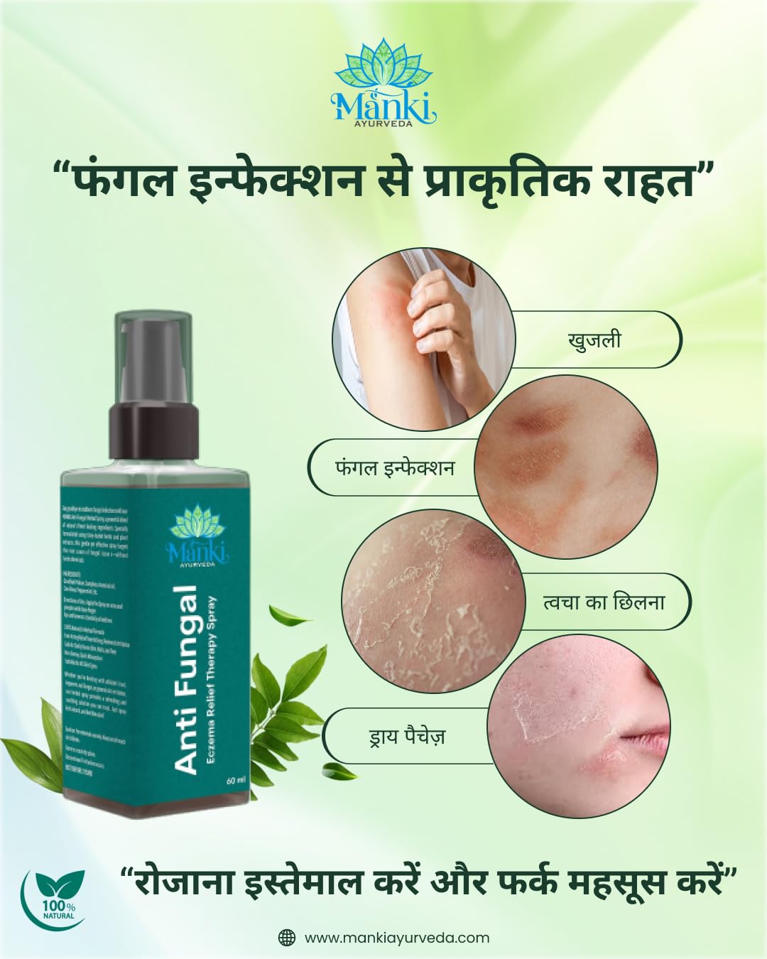 Herbal Anti Fungal Spray | Skin Care Spray for Itching, Odour & Irritation | Natural Ingredients | Suitable for Feet, Underarms & Body | 60ml - Image 2
