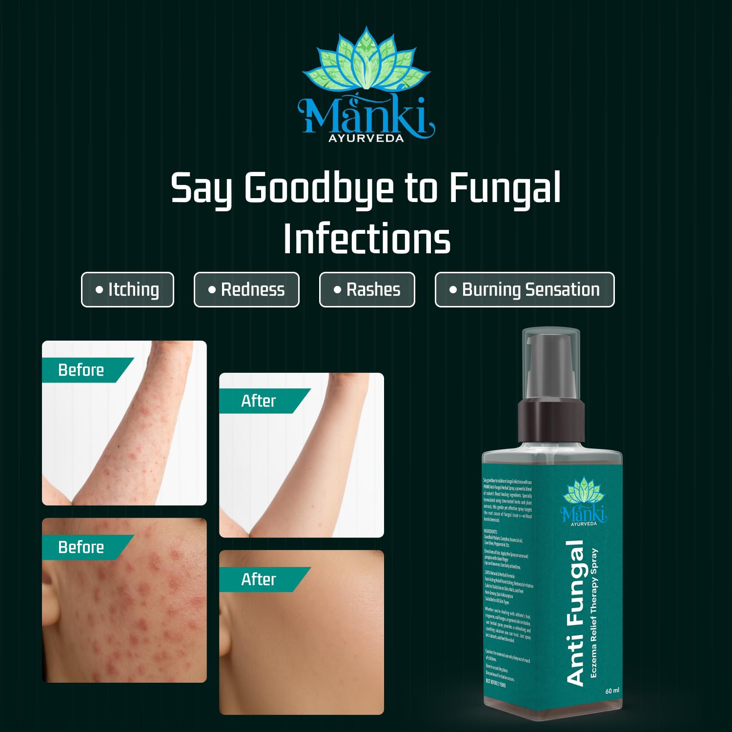 Herbal Anti Fungal Spray | Skin Care Spray for Itching, Odour & Irritation | Natural Ingredients | Suitable for Feet, Underarms & Body | 60ml - Image 5