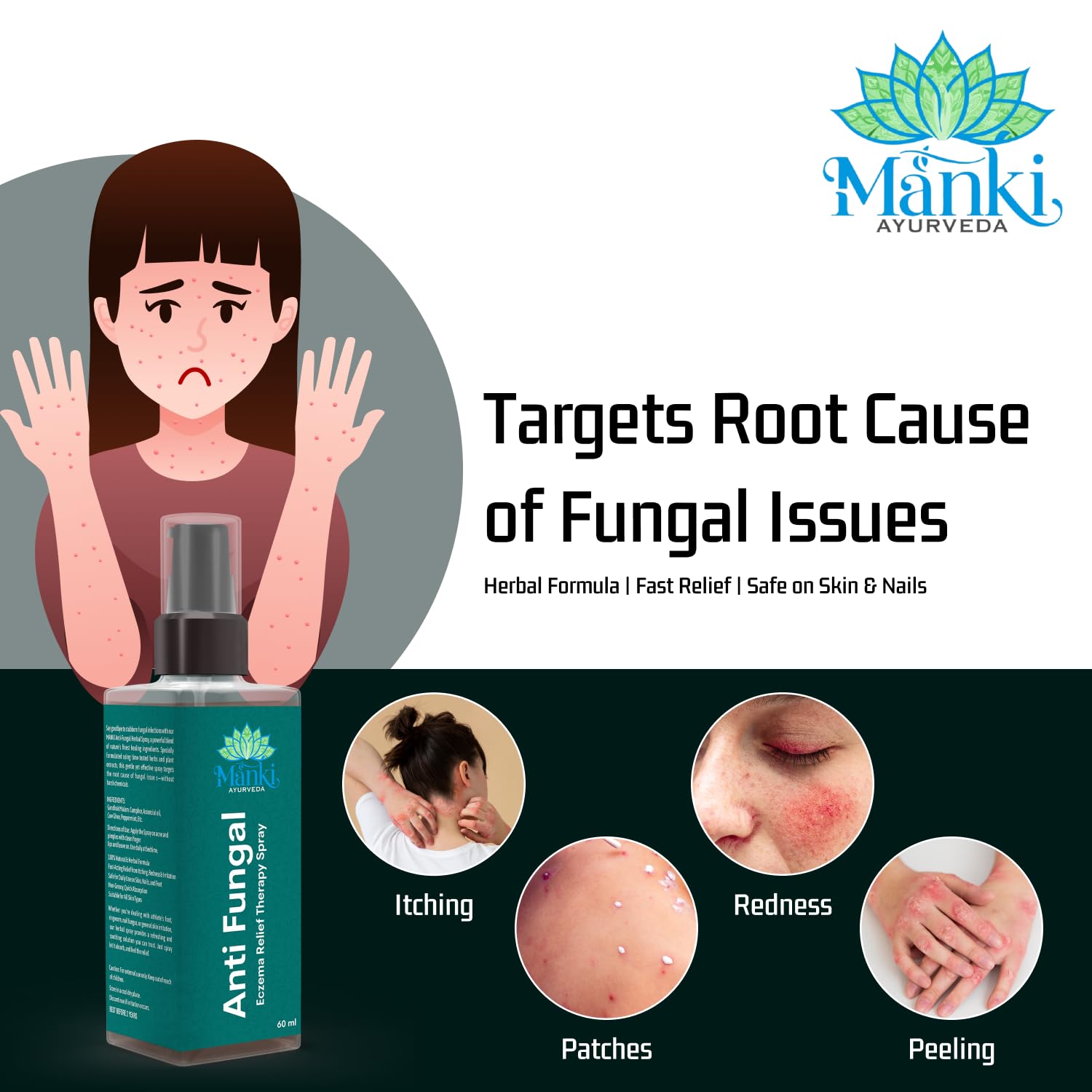 Herbal Anti Fungal Spray | Skin Care Spray for Itching, Odour & Irritation | Natural Ingredients | Suitable for Feet, Underarms & Body | 60ml - Image 4